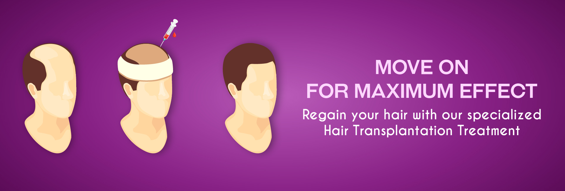 hair transplant in bangalore